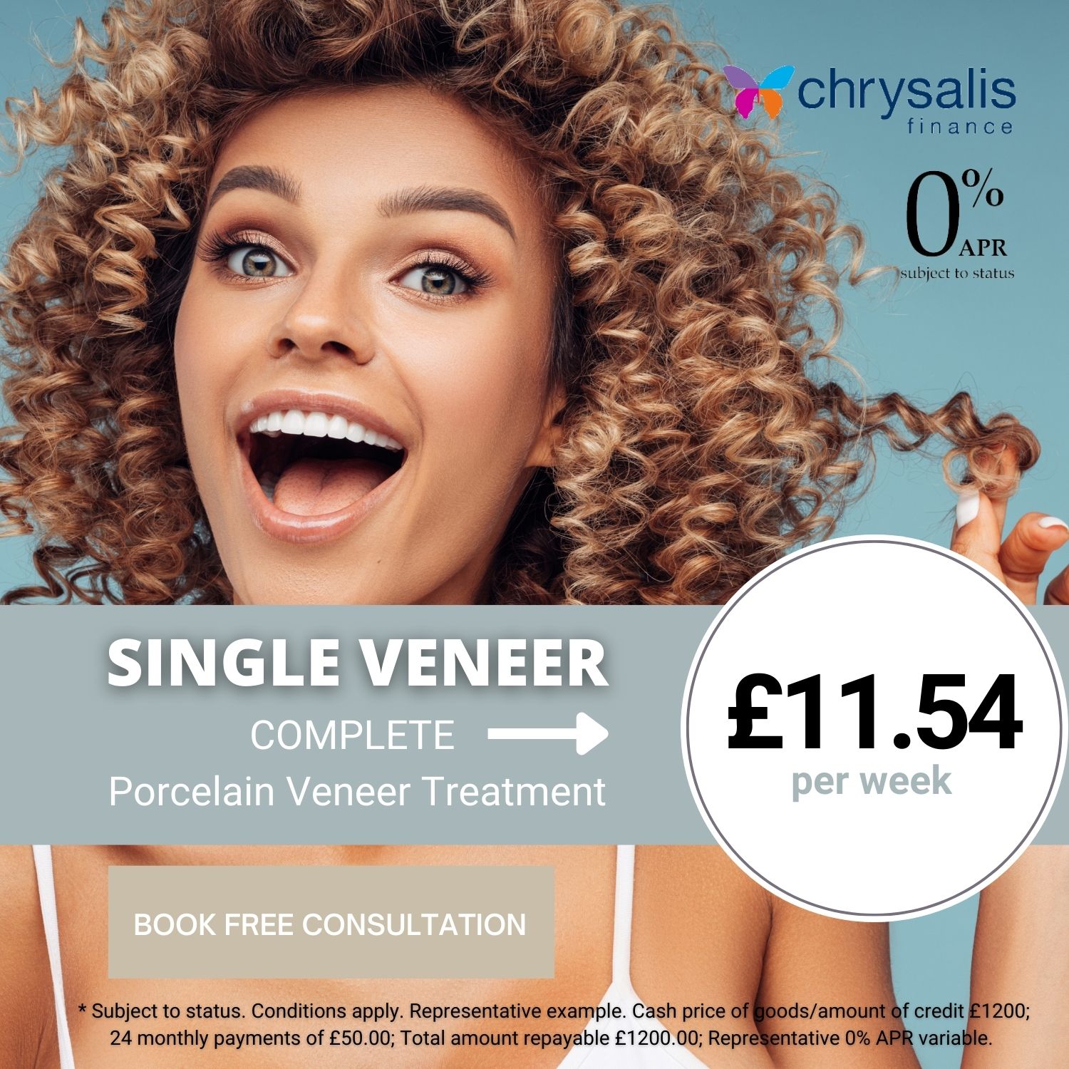 veneer offer