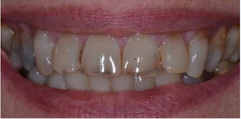 Dr Sam Jethwa’s Before