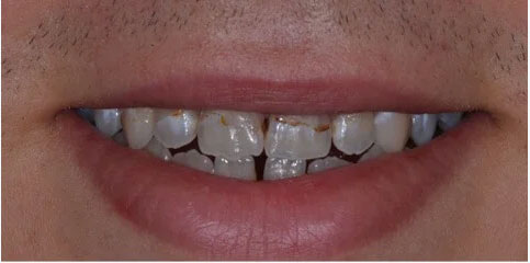 Dr Sam Jethwa’s Before