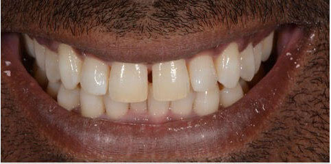 Dr Sam Jethwa’s Before