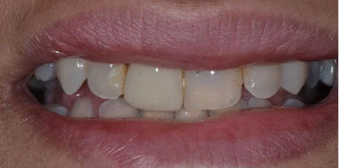 Dr Sam Jethwa’s Before