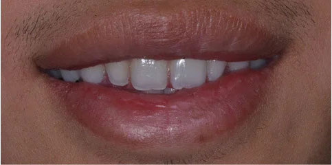 Dr Sam Jethwa’s Before