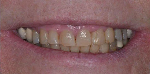 Dr Sam Jethwa’s Before