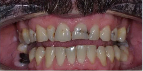 Dr Sam Jethwa’s Before