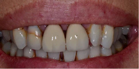 Dr Sam Jethwa’s Before