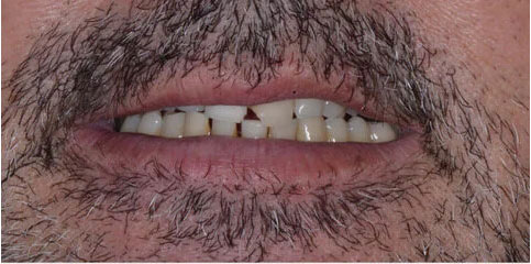 Dr Sam Jethwa’s Before