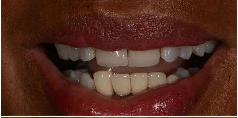 Dr Sam Jethwa’s Before