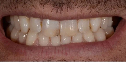 Dr Sam Jethwa’s Before