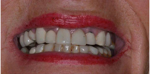 Dr Sam Jethwa’s Before