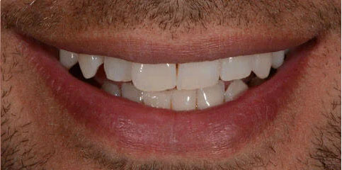 Dr Sam Jethwa’s Before