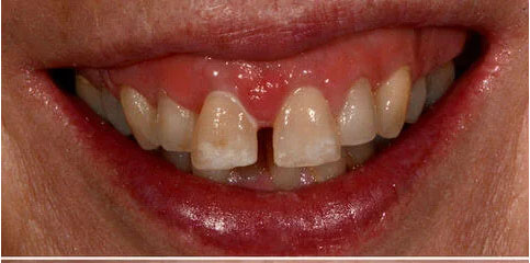 Dr Sam Jethwa’s Before