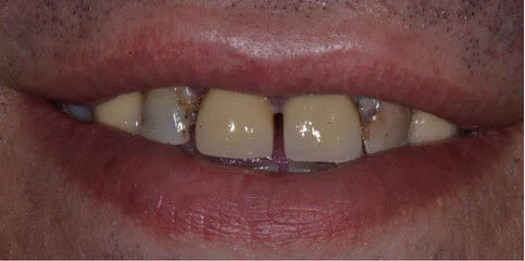 Dr Sam Jethwa’s Before