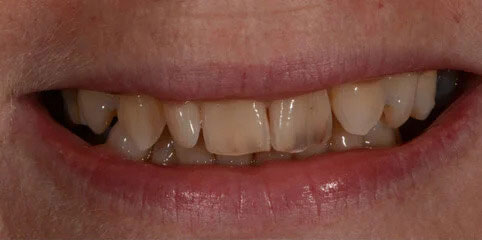 Dr Sam Jethwa’s Before