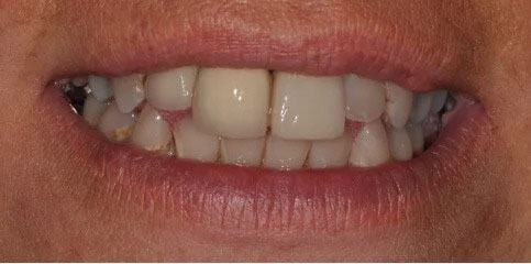 Dr Sam Jethwa’s Before