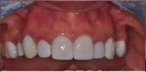 Dr Sam Jethwa’s Before