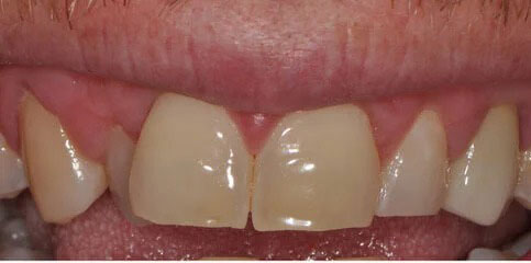 Dr Sam Jethwa’s Before