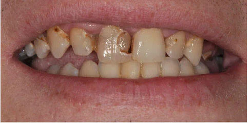 Dr Sam Jethwa’s Before