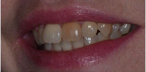 Dr Sam Jethwa’s Before