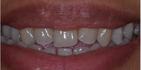 Dr Sam Jethwa’s Before